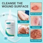 Dimora Skin and Wound Cleanser, First Aid Wound Wash Solution 8oz/237ml - Image 2